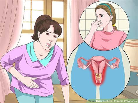 how to avoid ectopic pregnancy 8 steps with pictures wikihow
