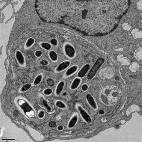 salmonella typhimurium growing   macrophage biologyatberkeley