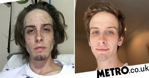 Drug Addict Posts Inspiring Before And After Photos To Celebrate