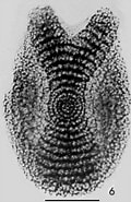 Afbeeldingsresultaten voor "amphirhopalum Ypsilon". Grootte: 120 x 185. Bron: www.radiolaria.org