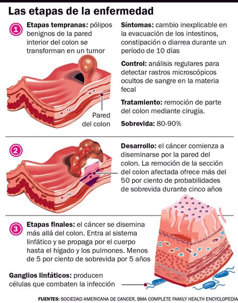 el cancer de colon se puede prevenir en el  de los casos pero pocos se controlan