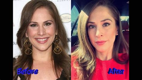 ana kasparian nose job pictures cost malpractice victim fail youtube