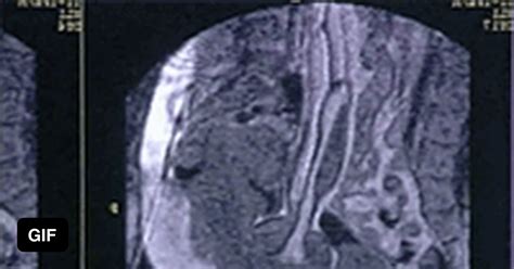 an mri scan of a couple having sex 9gag