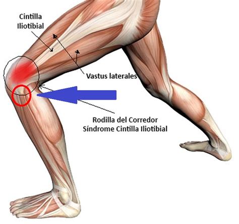 Dolor Exterior De La Rodilla Altura De La Cabeza Del