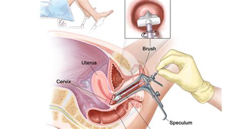 Women Health Mygyno Obstetric And Gynecology Kenya