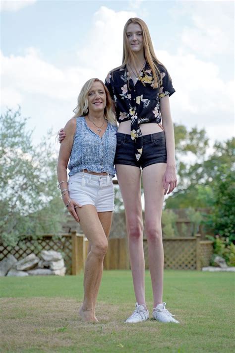 teen with record breaking long legs urges people to embrace their