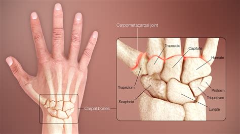anatomy shoulder  upper limb hand carpal bones article