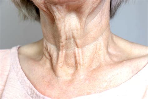 sagging neck    tighten   surgical diy home tips