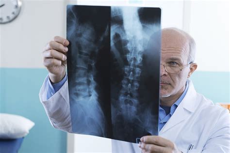 Spinal Stenosis When Is Surgery The Best Option For Better Us News