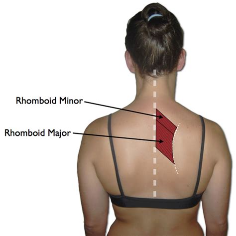 rhomboid trigger points  pain   shoulder blades