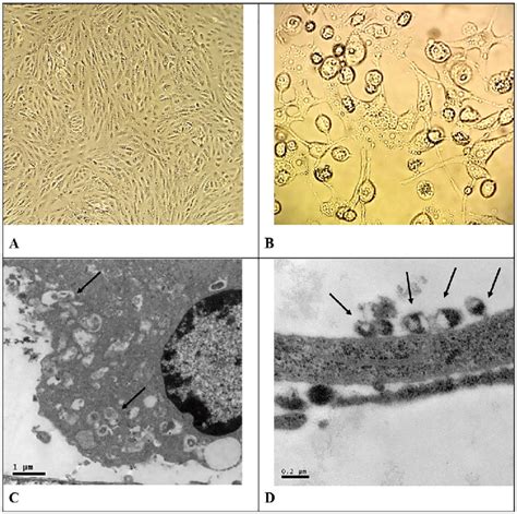 morphological aspects of vero cells infected with zika virus zkv download scientific