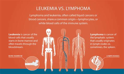 lymphoma  leukemia understanding  differences