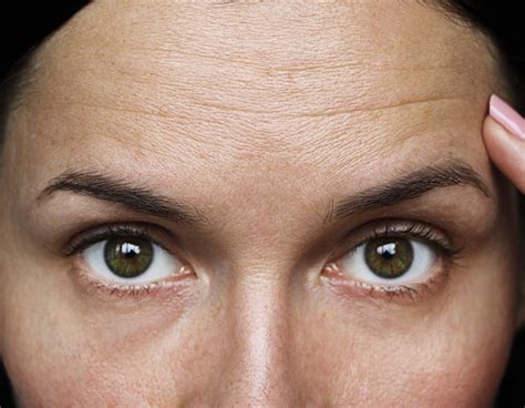 anti aging ingredients  diminishing forehead wrinkles