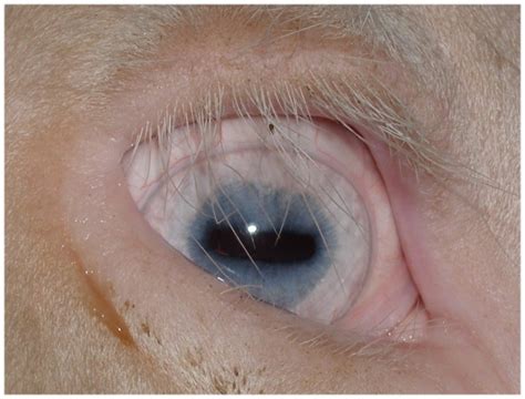 cilia eyelashes eyelids nictitating membrane  conjunctiva