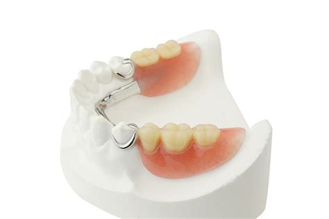 partial dentures voyles family dental