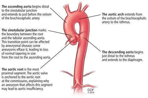 thoracic aortic aneurysm   counsel   refer cleveland