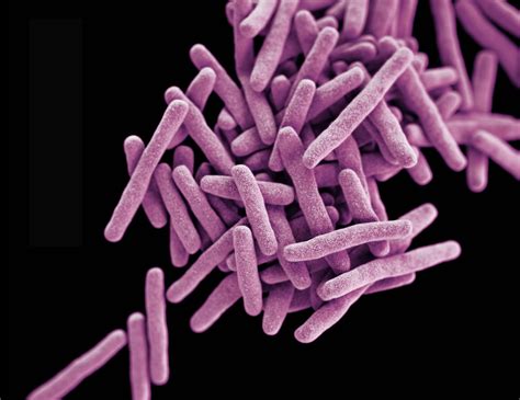 tuberculosis bacteria thrive   nitrogen source buffet elife