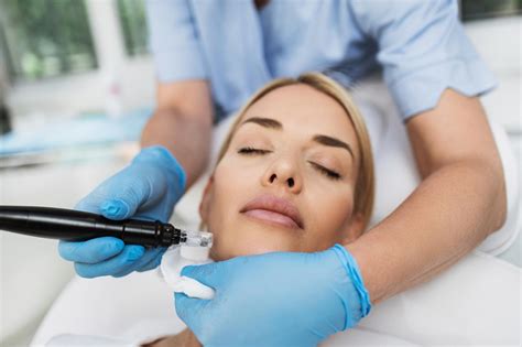 microneedling  skin concerns skin deep med spa