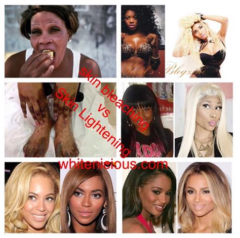 whitenicious boss dencia explains the differences between skin lightening and skin bleaching