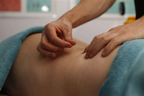 dry needling melbourne dry needle therapy muscle freedom