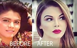 Image result for Rakhi Sawant Before and After Surgery. Size: 159 x 100. Source: starbiz.com