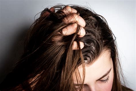 oily hair remedies  easy ways   rid  greasy hair
