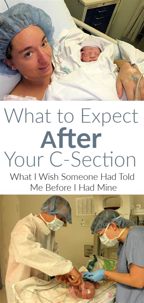 What To Expect After A C Section C Section C Section Recovery C