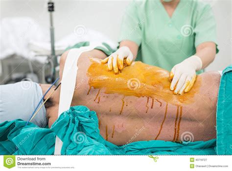 scrub nurse scrub patient prepare for chest operation