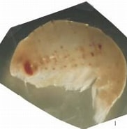 Afbeeldingsresultaten voor "thyropus Sphaeroma". Grootte: 182 x 168. Bron: www.odb.ntu.edu.tw