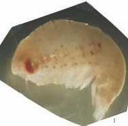 Afbeeldingsresultaten voor Thyropus Sphaeroma Klasse. Grootte: 188 x 168. Bron: www.odb.ntu.edu.tw