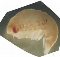 Afbeeldingsresultaten voor Thyropus Sphaeroma Rijk. Grootte: 195 x 168. Bron: www.odb.ntu.edu.tw