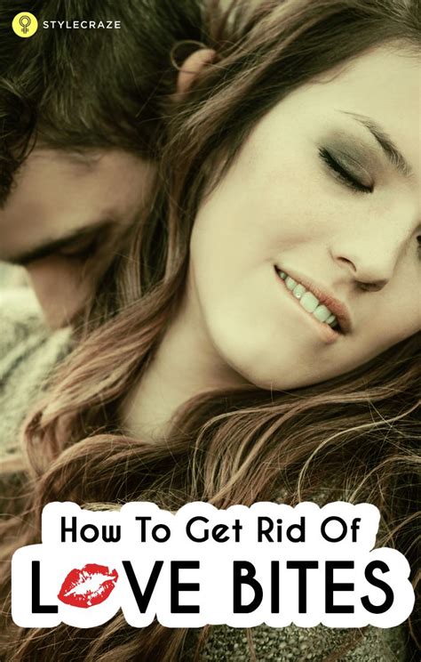 how to get rid of a hickey 11 simple ways how to