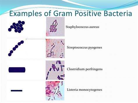 Gram Positive Cocci Examples Morphology Of Gram Positive Cocci