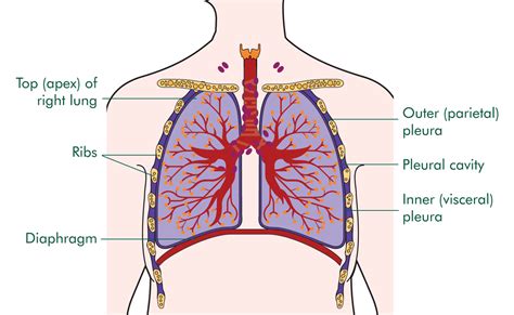 What Is Mesothelioma Mesothelioma Informations