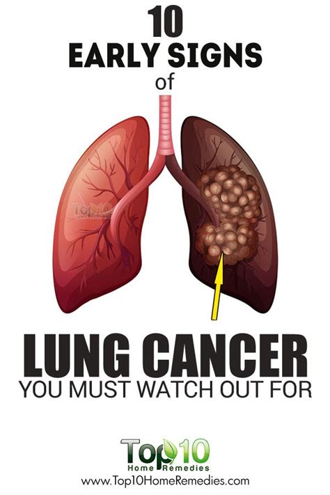 Watch Out Early Signs And Symptoms Of Lung Cancer You Shouldn T Ignore