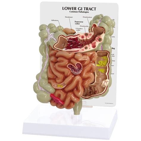 anatomical model colon andgi tract