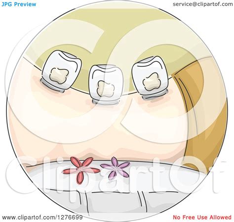 Clipart Of A Cupping Therapy Massage Icon Royalty Free