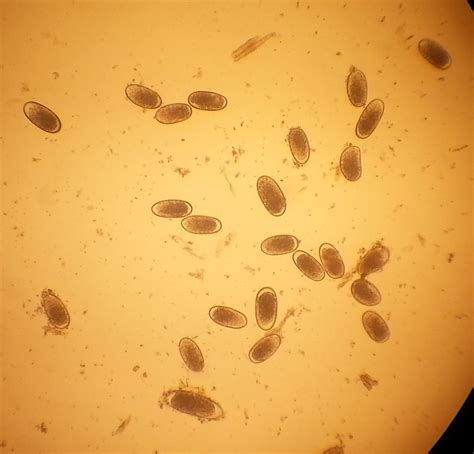 cat intestinal parasites under microscope
