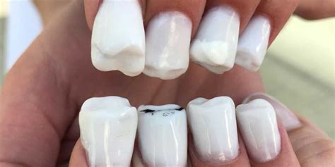teeth nail art — molar tooth weird nail art trend