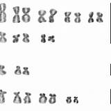 Chromosomes Karyotype Arranged Diversicolor Decreasing sketch template