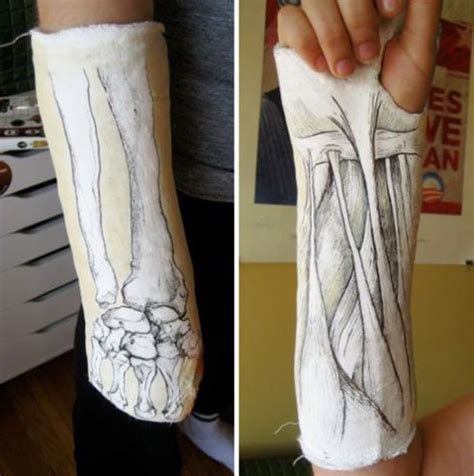 30 Creative Cast Designs That Prove You Can Still Look Cool With An Injury