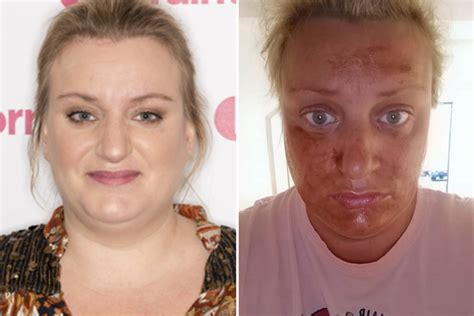 actress daisy may cooper begs for help after fake tan disaster and it