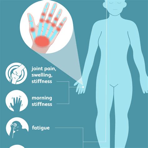 rheumatoid arthritis signs symptoms  complications