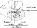 Carpal Tunnel Syndrome Diagram Treatments Causes Showing Illustrations sketch template