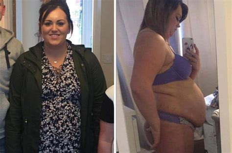 Obese Woman Shamed Into Losing Weight You Won’t Believe