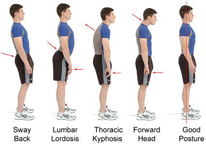 improve  posture