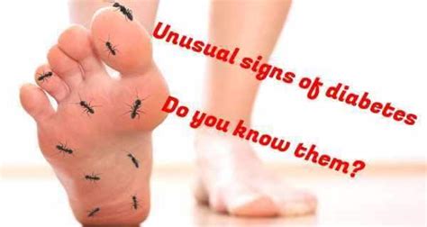 5 Unusual Signs Of Diabetes You Should Watch Out For