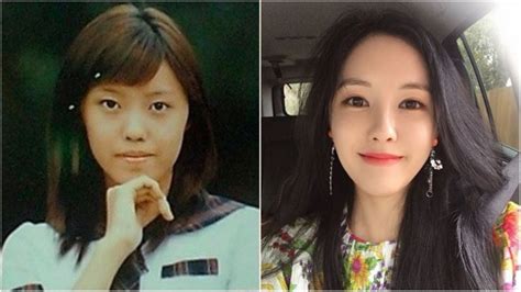 K Pop Stars Before And After Plastic Surgery