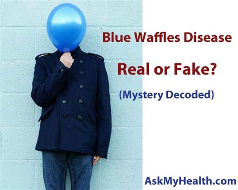 Blue Waffles Disease In Women And Men With Pictures Mystery