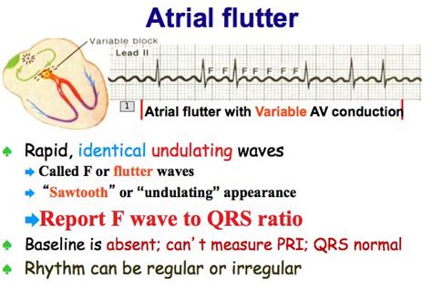 atrial flutter and atrial fibrillation